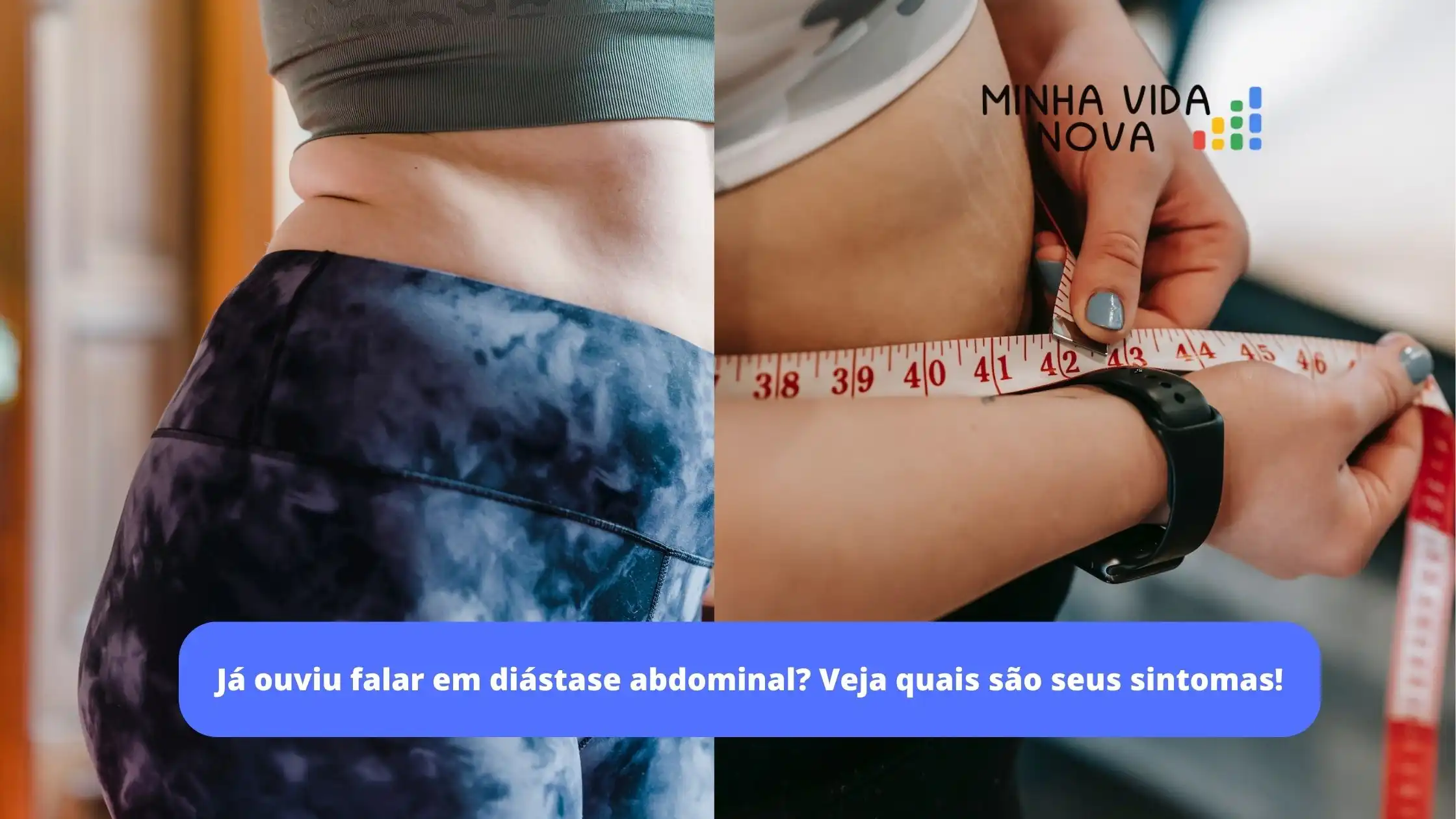 sintomas de diástase abdominal