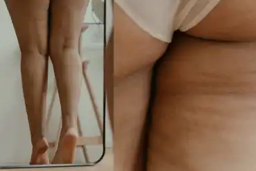 Home 11 emagrecer diminui celulite