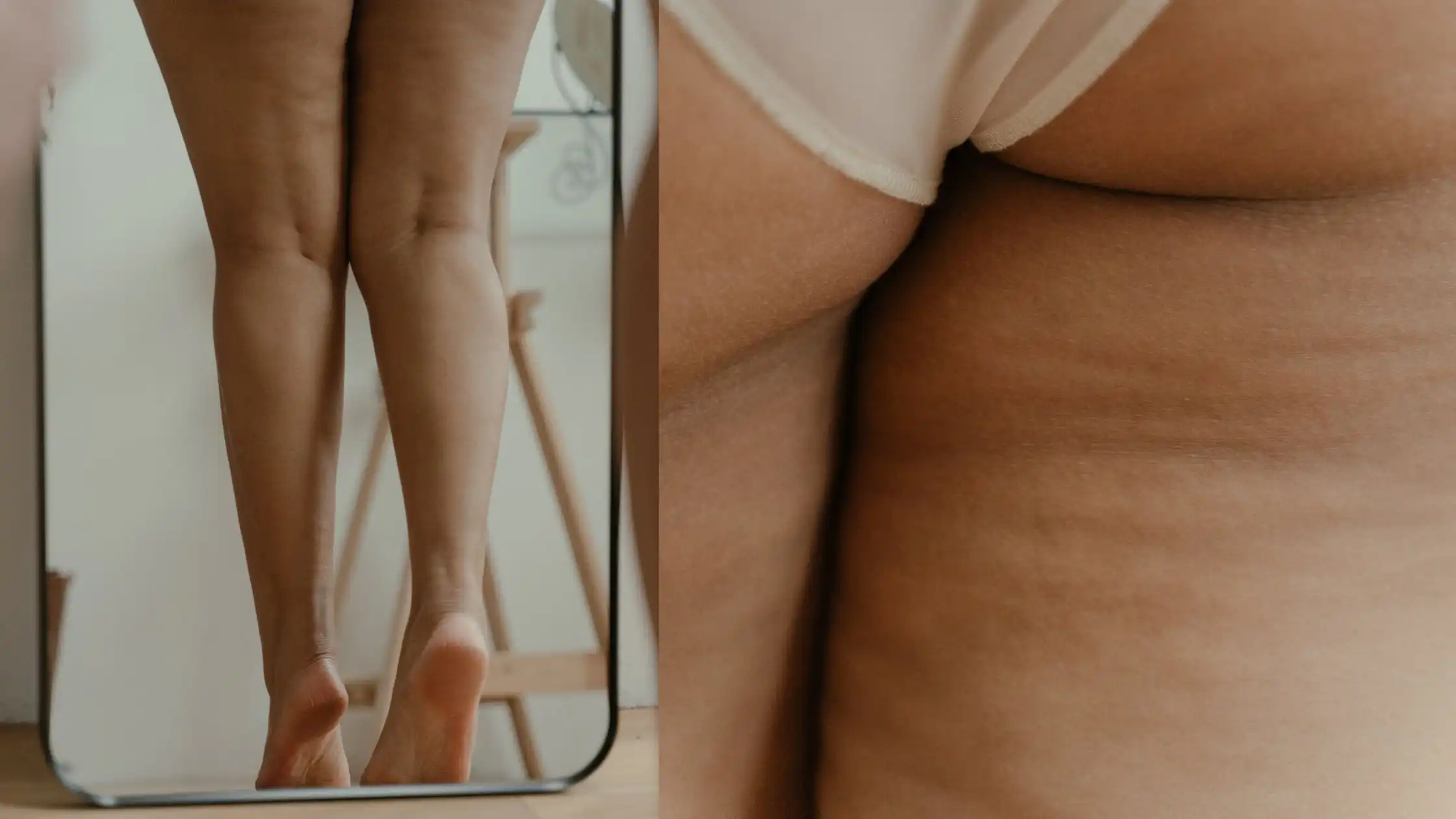 emagrecer diminui celulite